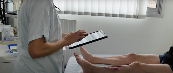 Pixacare pourrait réduire de trois jours la durée d'hospitalisation des patients.
